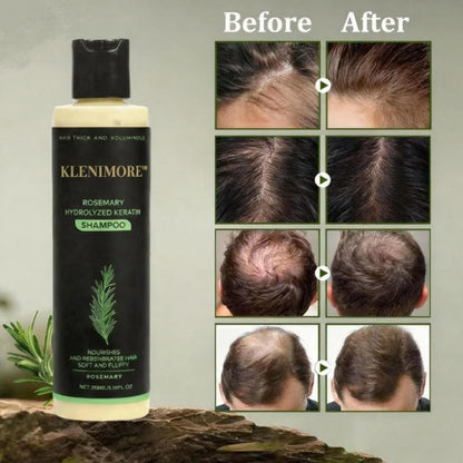 🌱Organic Rosemary Hair Growth Shampoog